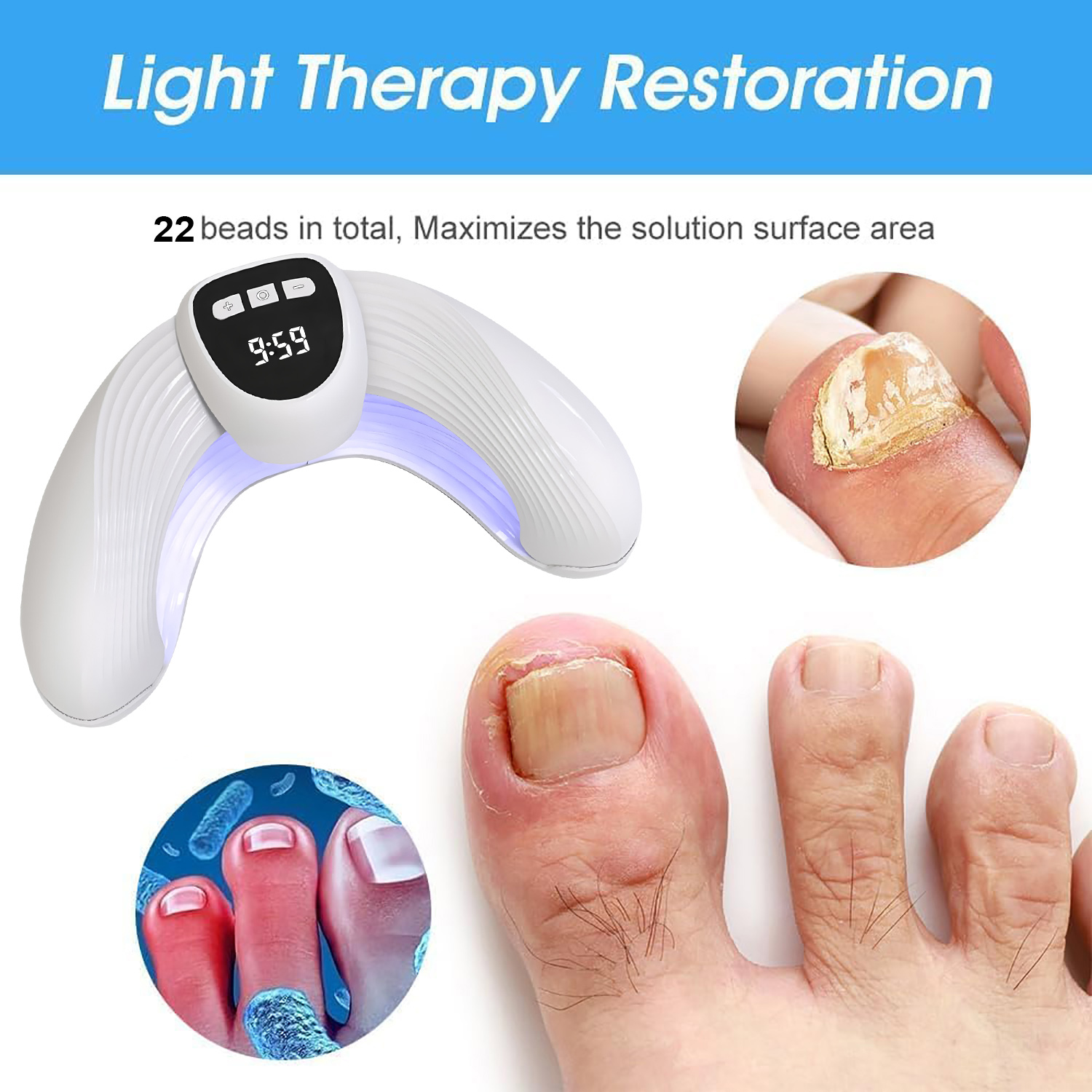 Laser Nail Fungus Treatment De - Industrial Laser Removal ulasan dan harga