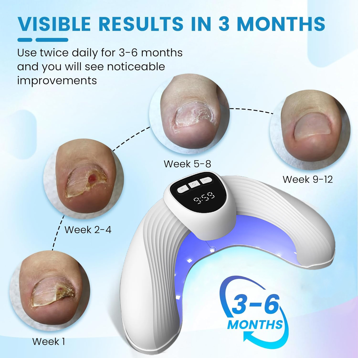 Laser Nail Fungus Treatment De - Industrial Laser Removal ulasan dan harga
