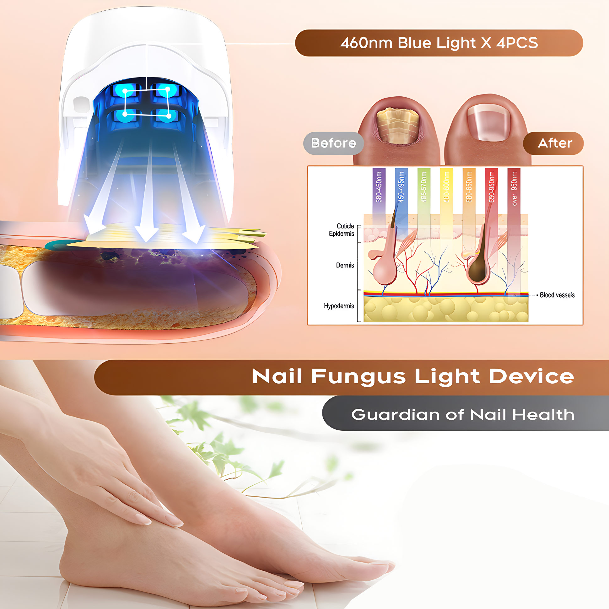 Nail Fungus Laser Assist Tool  - Industrial Laser Removal ulasan dan harga